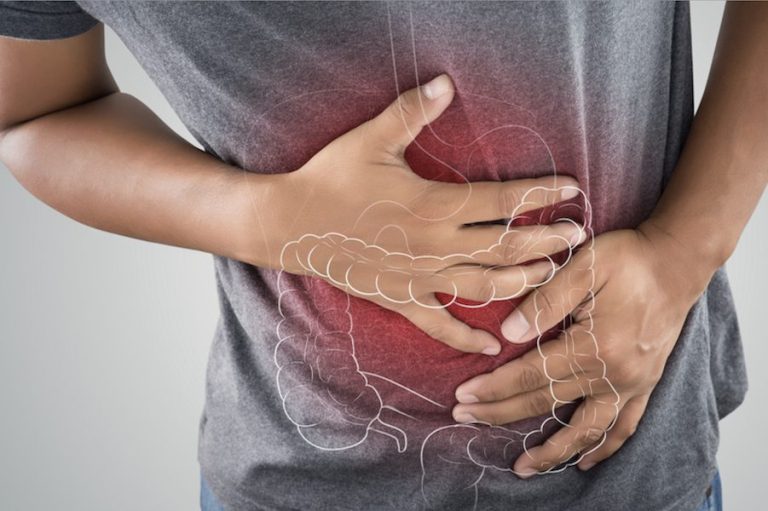 Inflammatory Bowel Disease (IBD)