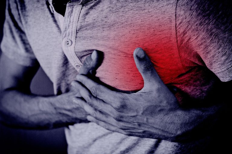 Atherosclerosis