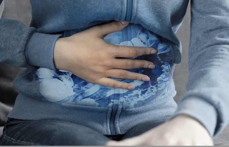 Crohn’s disease