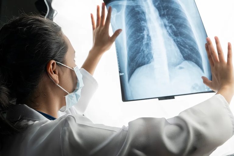 Mesothelioma