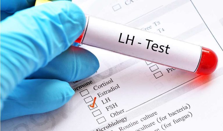 Leutinising hormone
