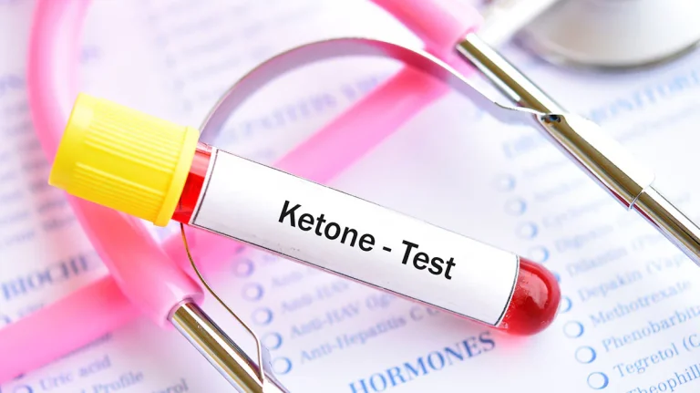 Ketoacidosis