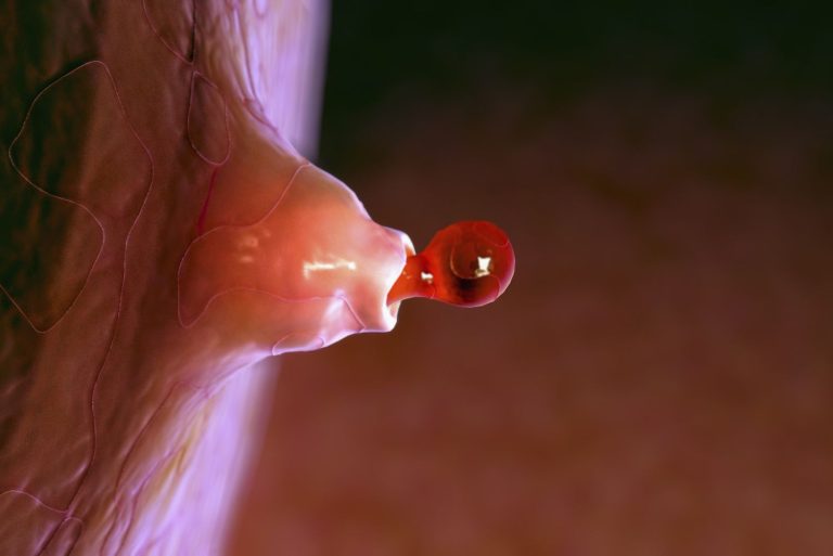 Follicle stimulating hormone